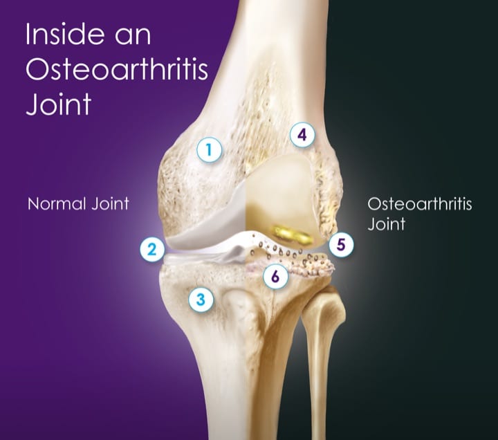 half-n-half-knee-2